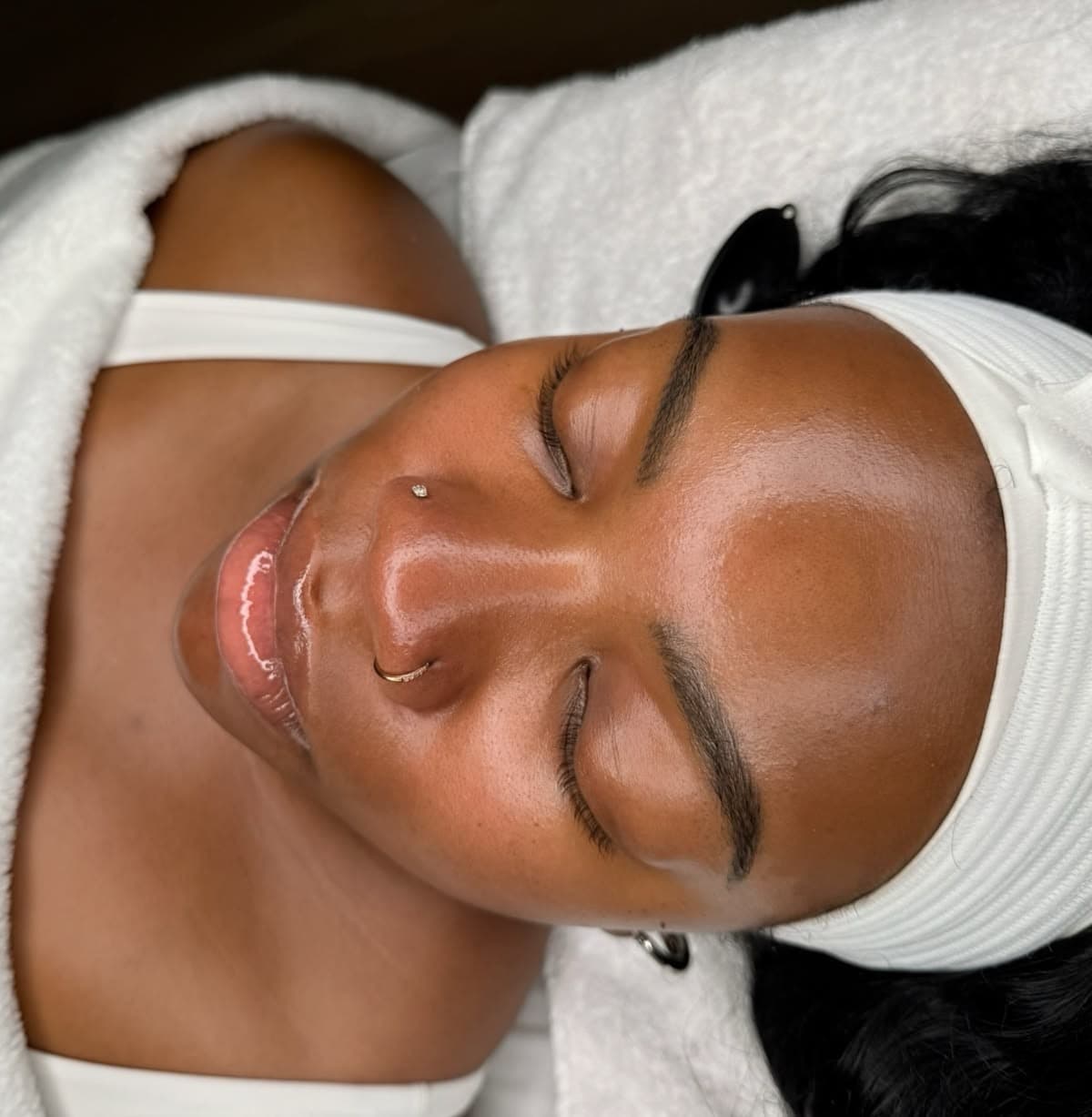 Micro dermabrasion signature